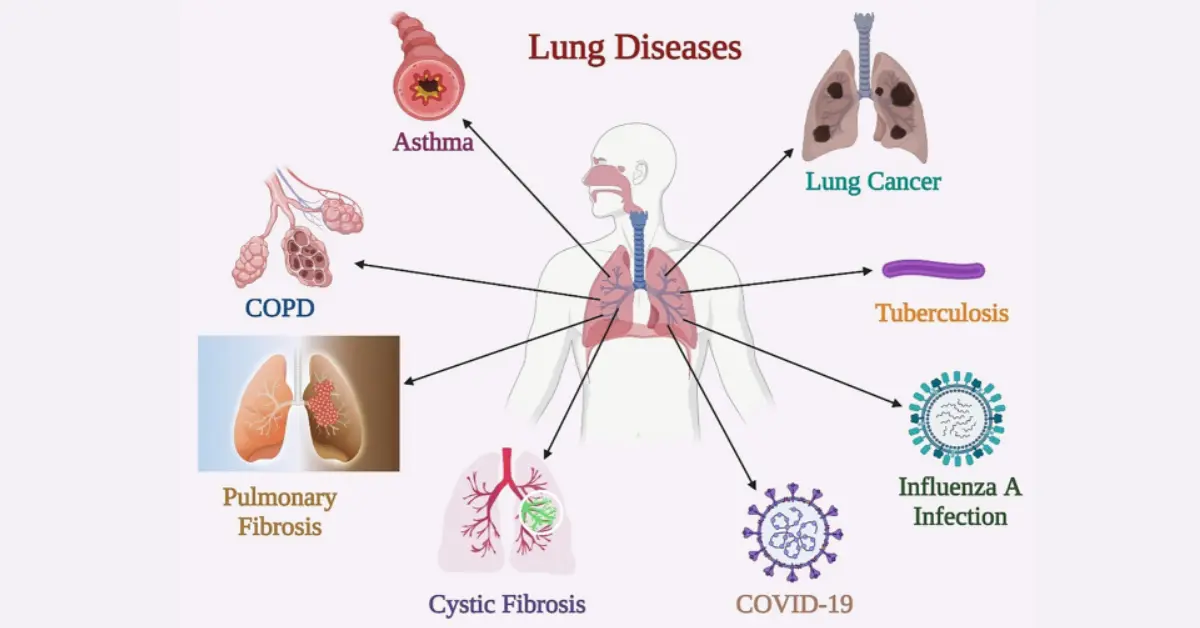 lung disease