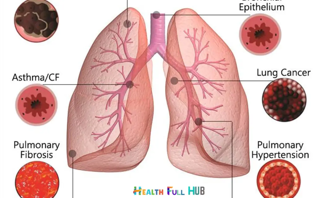 lung disease