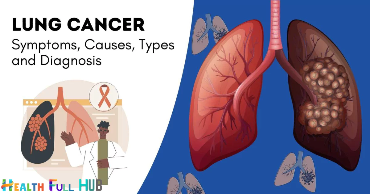 Lung Cancer Symptoms